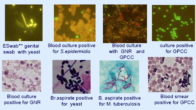 wasp gram smear pic 3.PNG