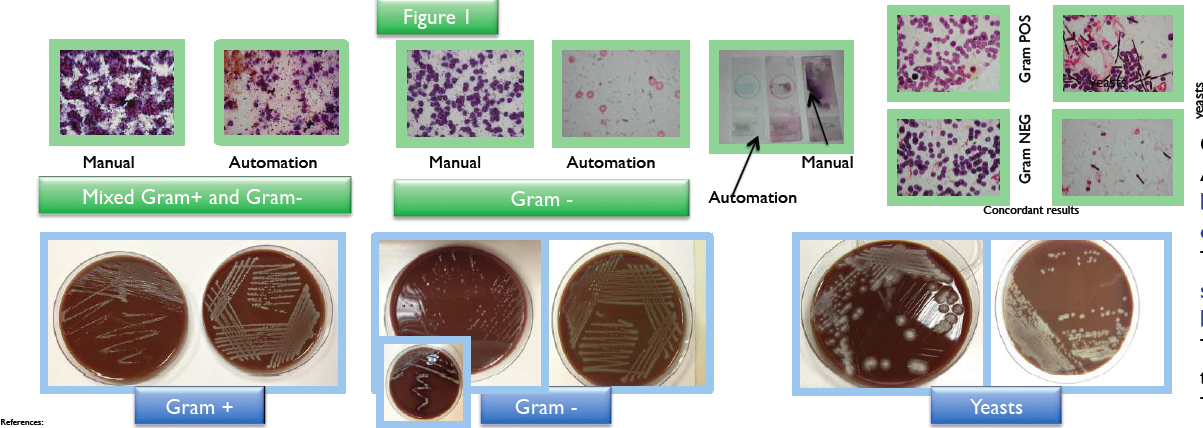 ECCMID Blood WASP 2.PNG