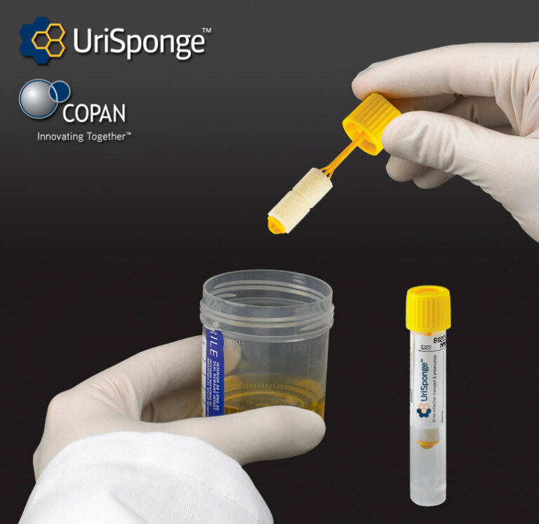 FDA Cleared UriSponge™ for More Convenient Urine Collection