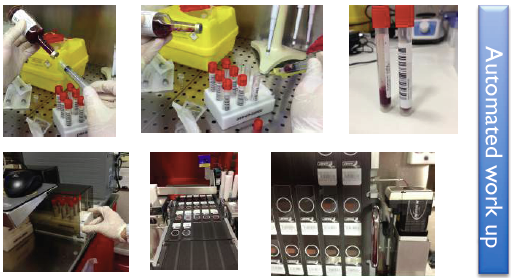 ECCMID Blood WASP 3.PNG