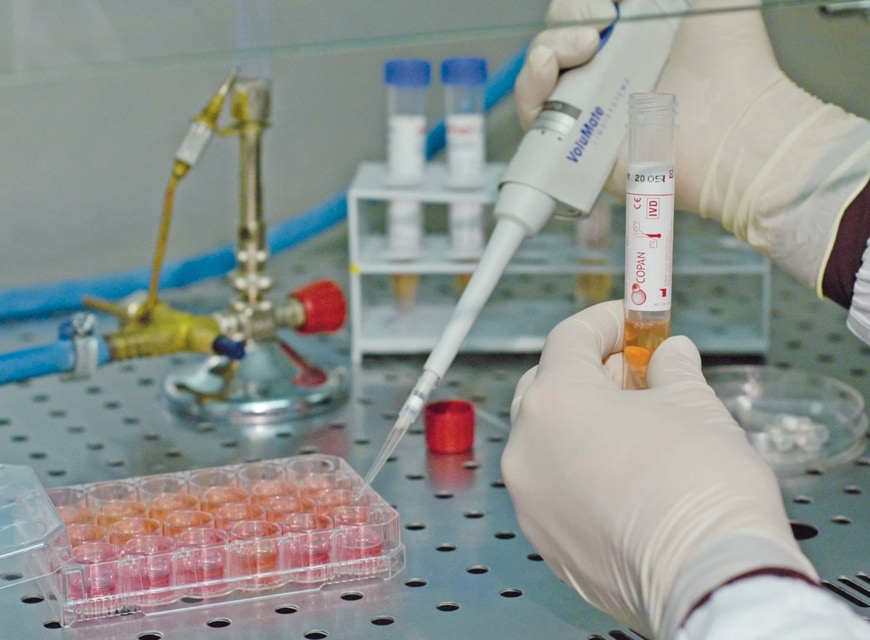 UTM In Use Pipetting Molecular Assays