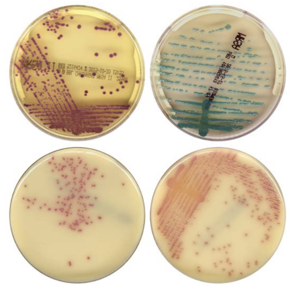 Золотистый стафилококк MRSA. Метициллинрезистый золотистый стафилококк. MRSA микробиология.