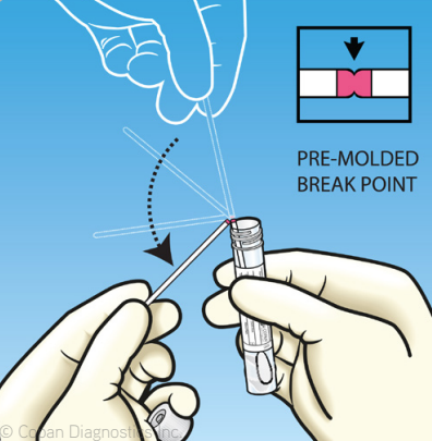 swab Breakpoint