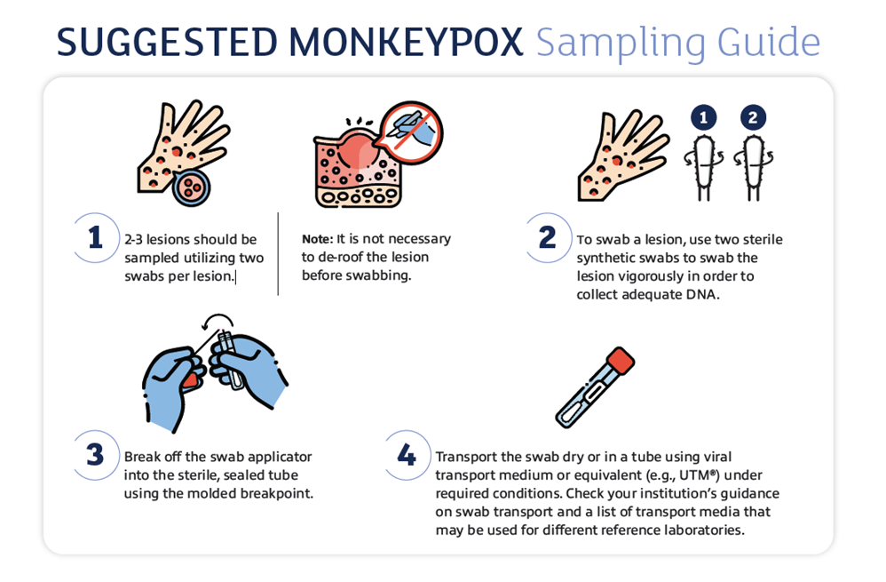Research Roundup Monkeypox Sample Collection and Transport COPAN